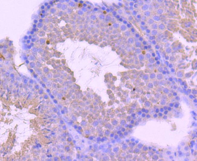 Anti-Androgen receptor Antibody (3T582)