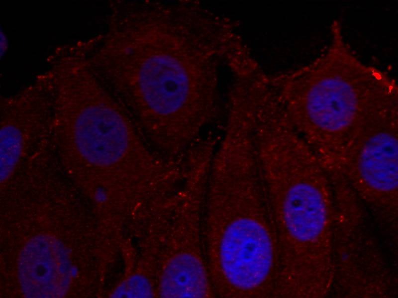 Anti-Phospho-Alpha-Synuclein (Tyr133) Polyclonal Antibody