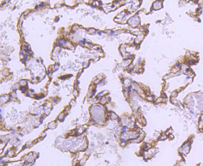 Anti-ACTA2 Antibody (1S368)