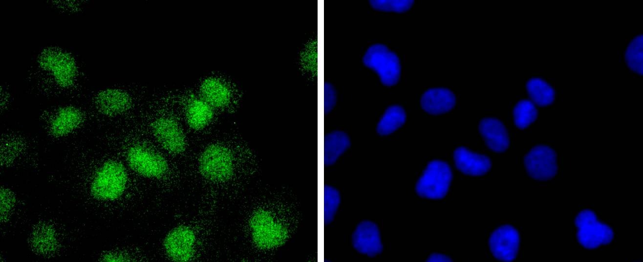 Anti-ATF1 Antibody (7A32)
