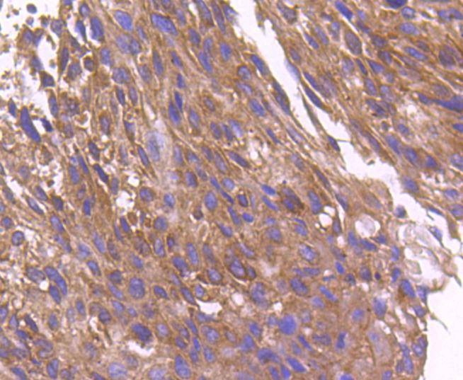 Anti-ARF1 Antibody (3P306)