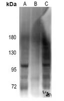 Anti-Phospho-Androgen receptor (Ser213) Polyclonal Antibody 2