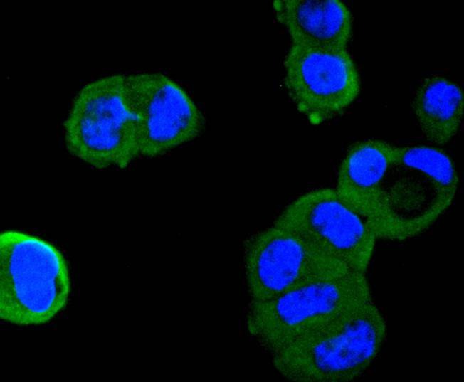 Anti-AGT Antibody (1Z261)