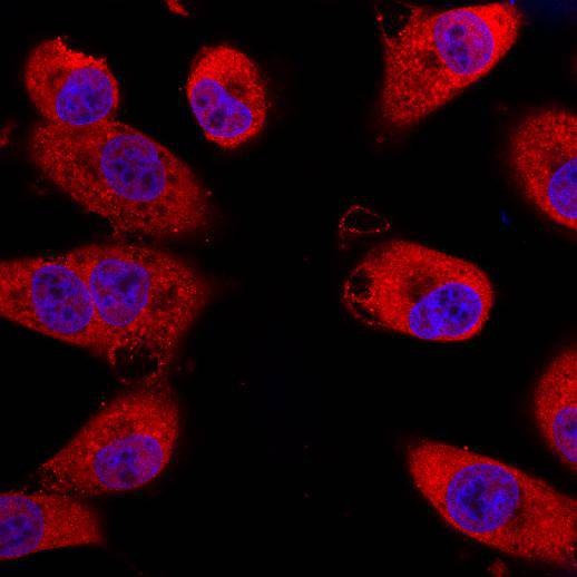 Anti-ACTA2 Antibody (1X82)