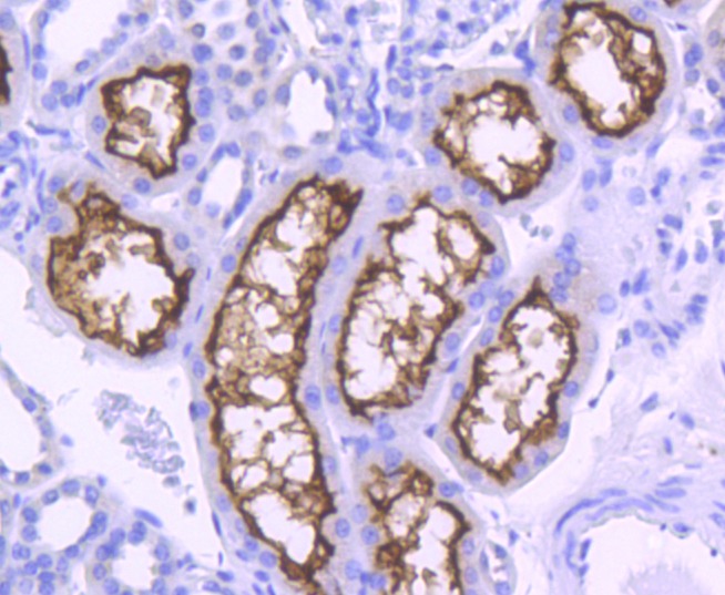Anti-ACE2/ACEH Antibody (3P140)