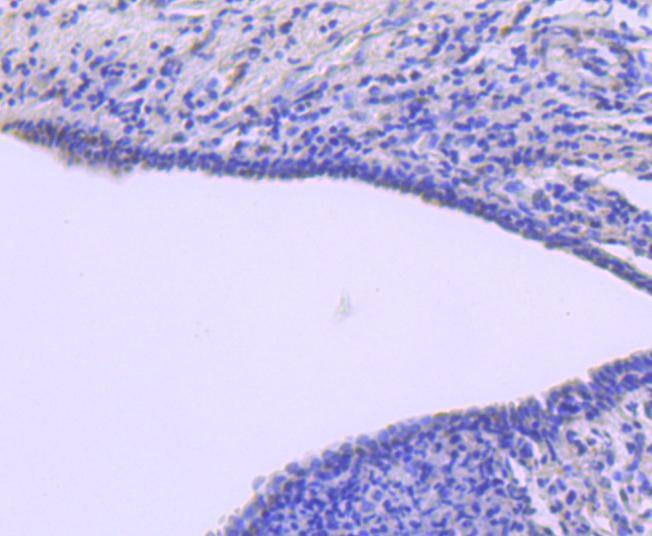 Anti-ATF1 Antibody (7A32)
