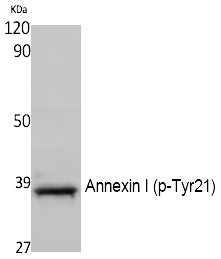 Anti-Phospho-ANXA1 (Tyr21) Polyclonal Antibody