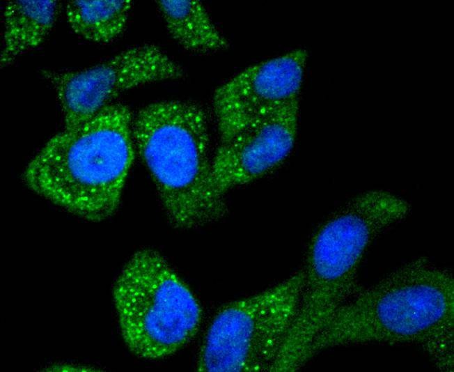 Anti-Asparagine synthetase Antibody (3D193)