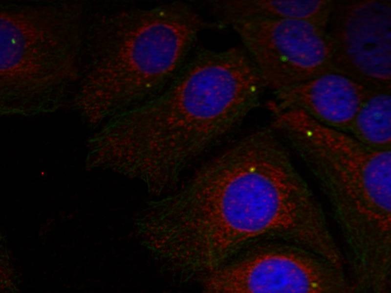 Anti-Phospho-Alpha-Synuclein (Tyr125) Polyclonal Antibody