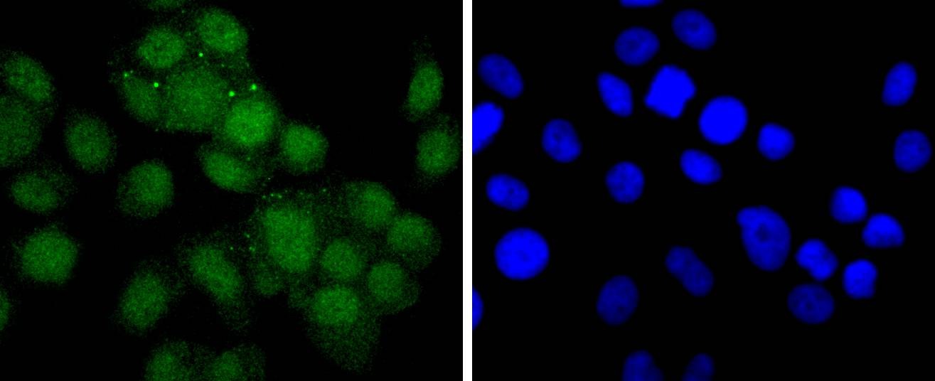 Anti-Androgen receptor Antibody (3T582)
