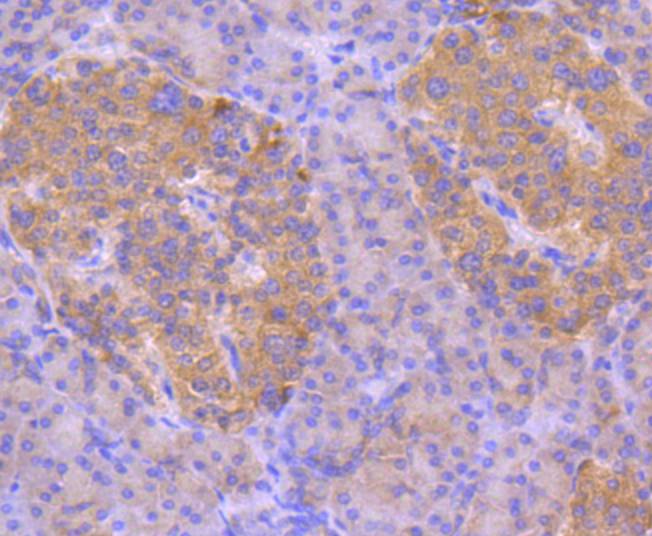 Anti-ASK1 Antibody (3O802)