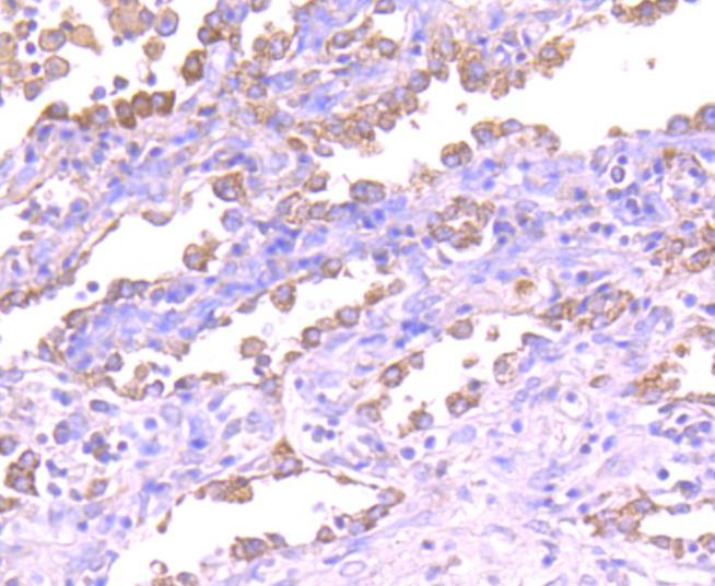 Anti-ASK1 Antibody (3O802)