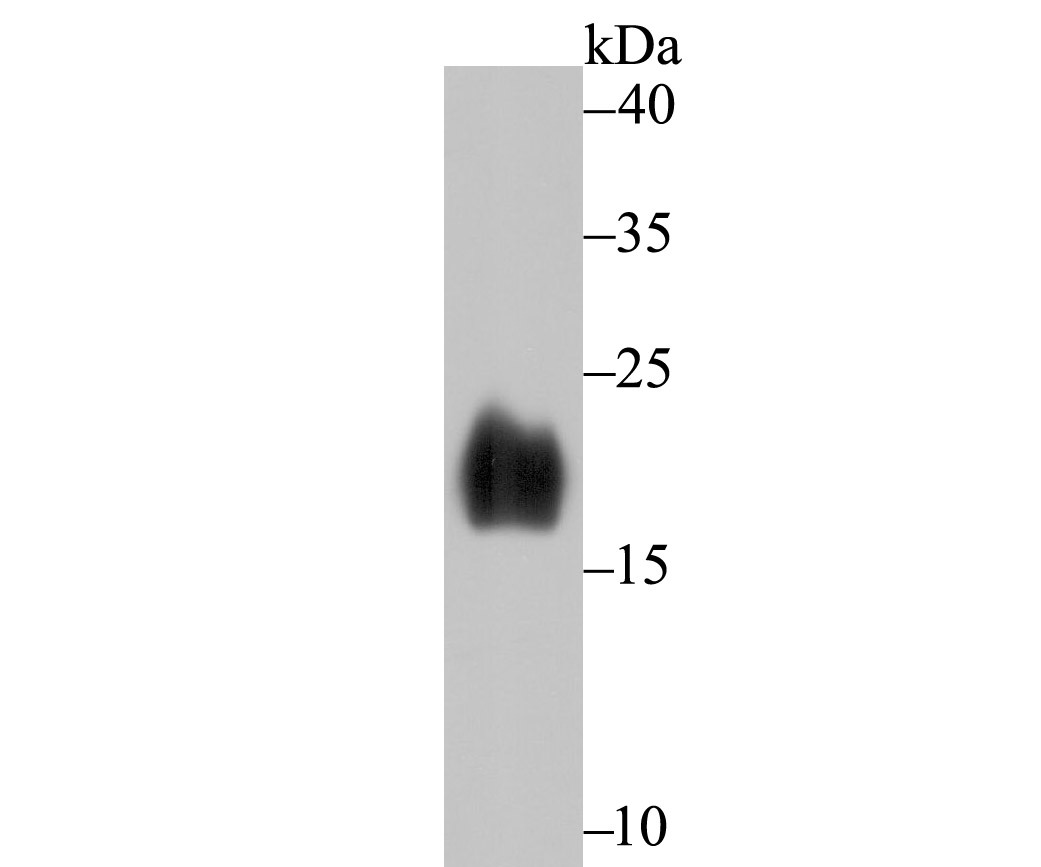 Anti-Alpha-Synuclein Antibody (2M749)