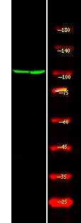 Anti-Phospho-Androgen receptor (Ser81) Polyclonal Antibody