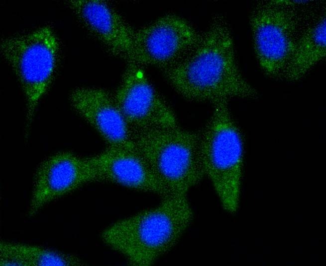 Anti-Alpha/Beta-Synuclein Antibody (5Q165)