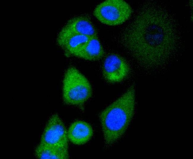 Anti-AP2M1 Antibody (9R605)