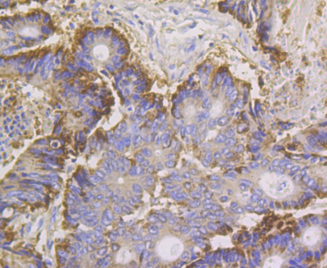 Anti-ANXA4 Antibody (3T392)