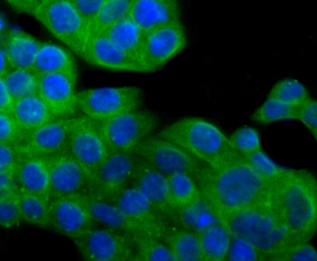 Anti-alpha Tubulin 4A Antibody (6I357)
