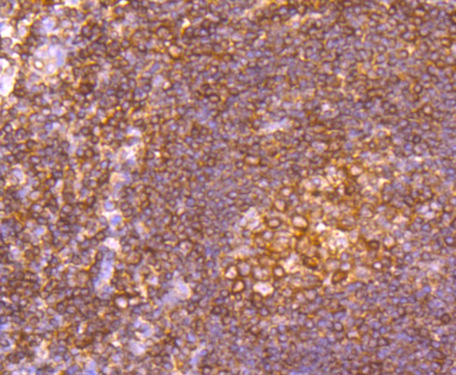 Anti-alpha Tubulin 4A Antibody (6I357)
