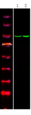 Anti-Phospho-Androgen receptor (Tyr534) Polyclonal Antibody