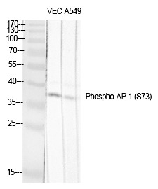 Anti-Phospho-JUN (Ser73, 100) Polyclonal Antibody