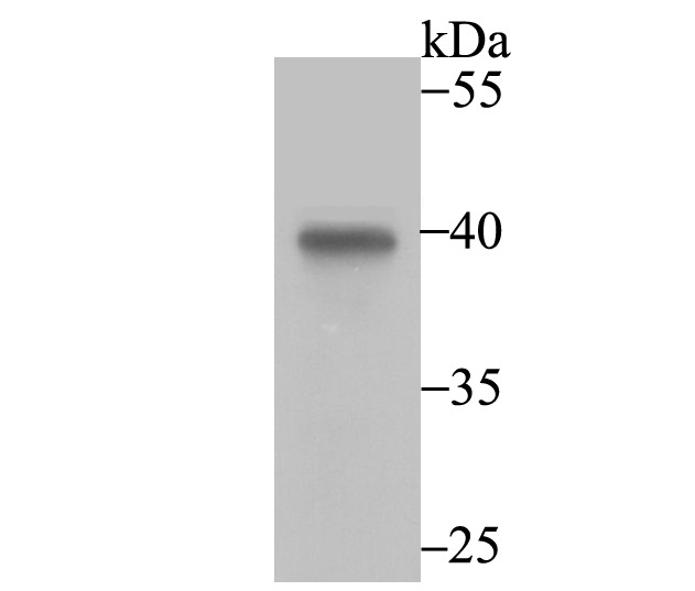 Anti-ANXA4 Antibody (3T392)