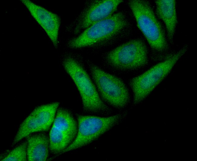 Anti-ANXA4 Antibody (3T392)