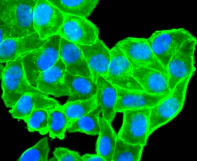 Anti-ACTA2 Antibody (3G548)