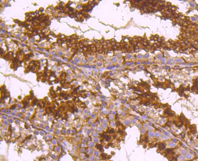 Anti-alpha Tubulin 4A Antibody (6I357)