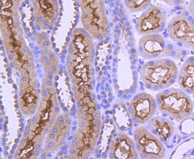 Anti-AP2M1 Antibody (9R605)