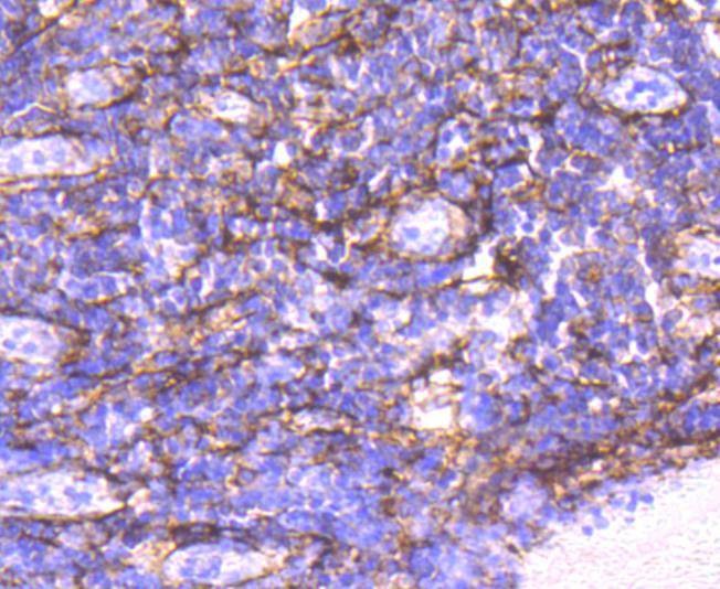Anti-ACTA2 Antibody (3G548)