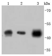Anti-ACTA2 Antibody (3G548)