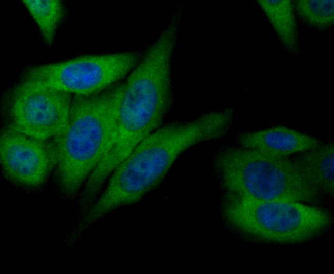 Anti-ANXA4 Antibody (3T392)