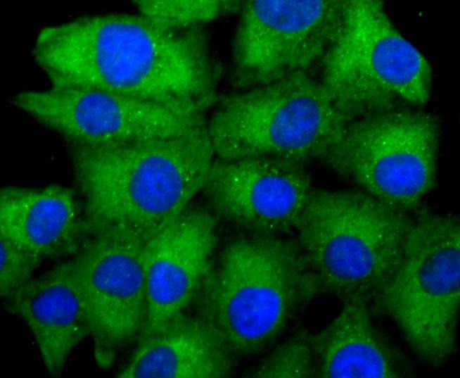 Anti-ASK1 Antibody (3O802)