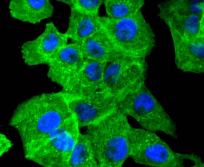 Anti-ACTA2 Antibody (3G548)
