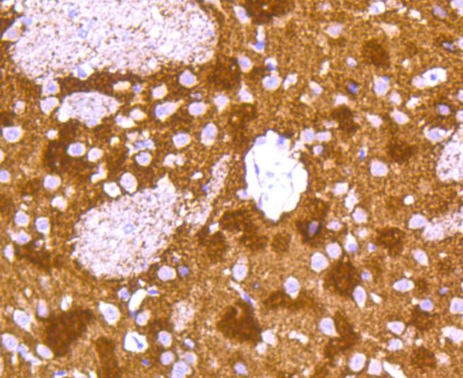 Anti-Alpha/Beta-Synuclein Antibody (5Q165)
