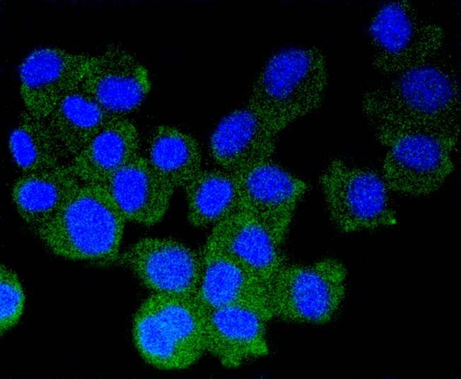 Anti-Alpha/Beta-Synuclein Antibody (5Q165)