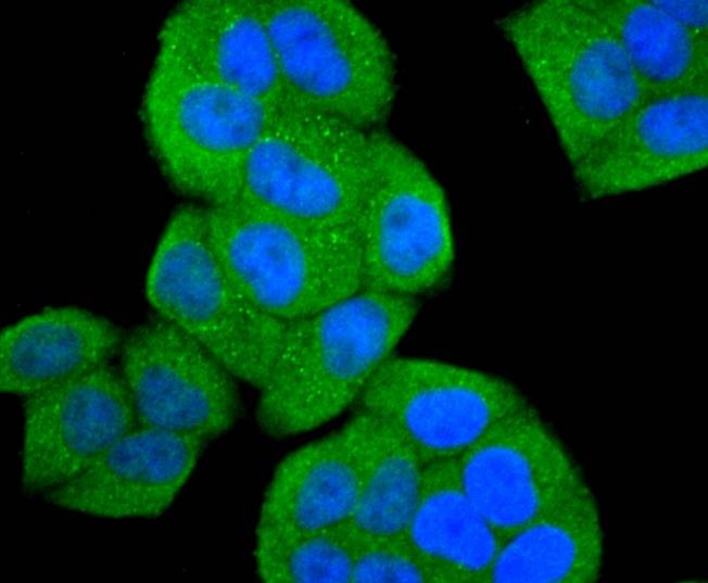 Anti-ASK1 Antibody (3O802)