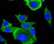 Anti-AP2M1 Antibody (9R605)