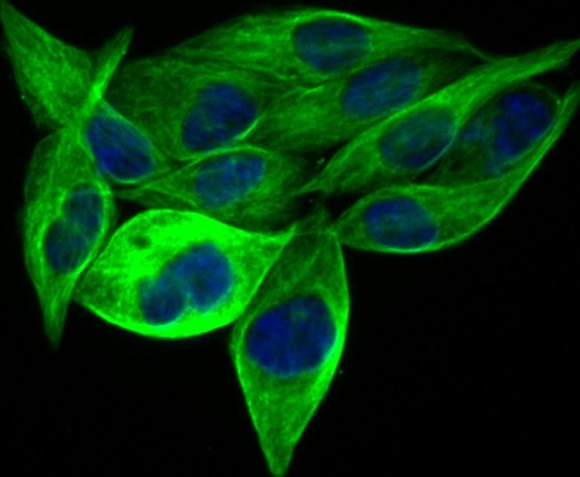 Anti-BCAP31 Antibody (4P206)