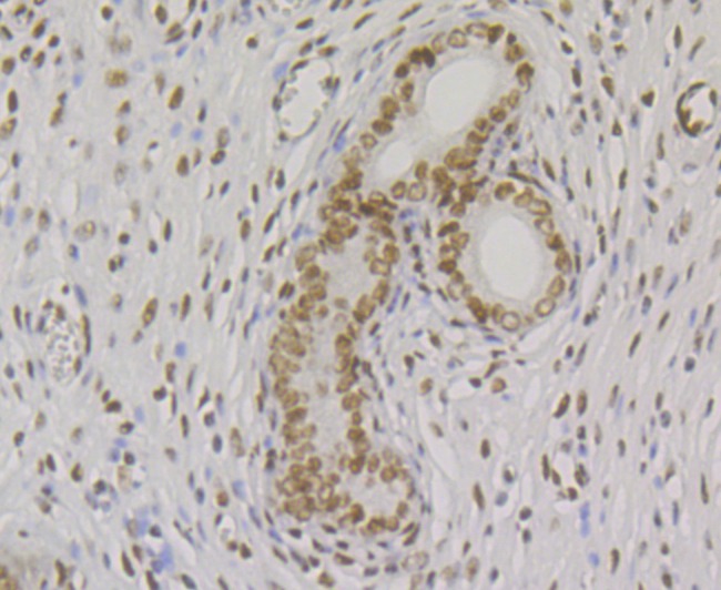 Anti-BAF57 Antibody (2O20)