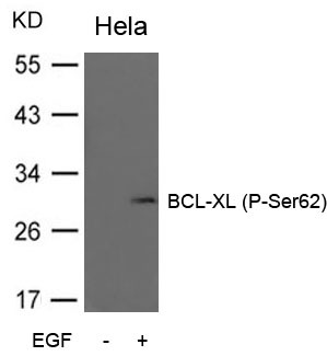 Anti-Phospho-BCL-XL (Ser62) Polyclonal Antibody 2