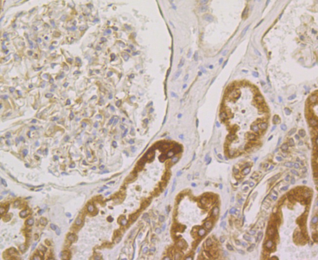 Anti-BCAP31 Antibody (4P206)