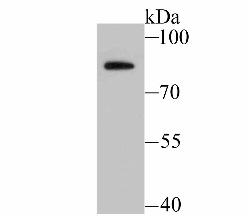 Anti-BDKRB2 Antibody (4Y573)