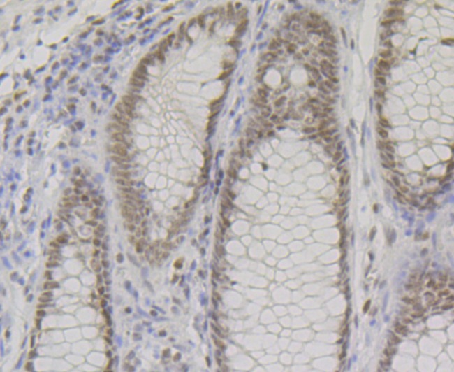 Anti-BAF57 Antibody (2O20)