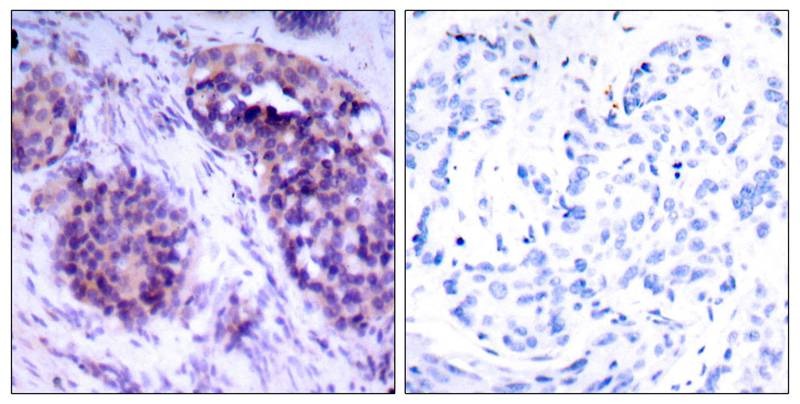 Anti-Phospho-BCL-XL (Ser62) Polyclonal Antibody 2