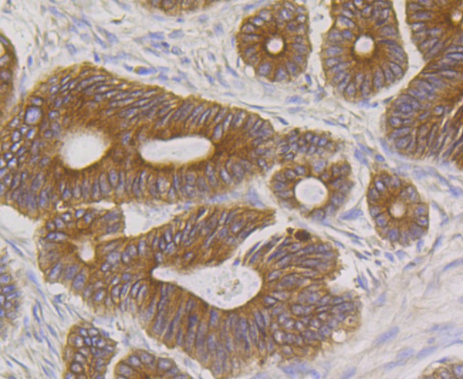 Anti-BCAP31 Antibody (4P206)