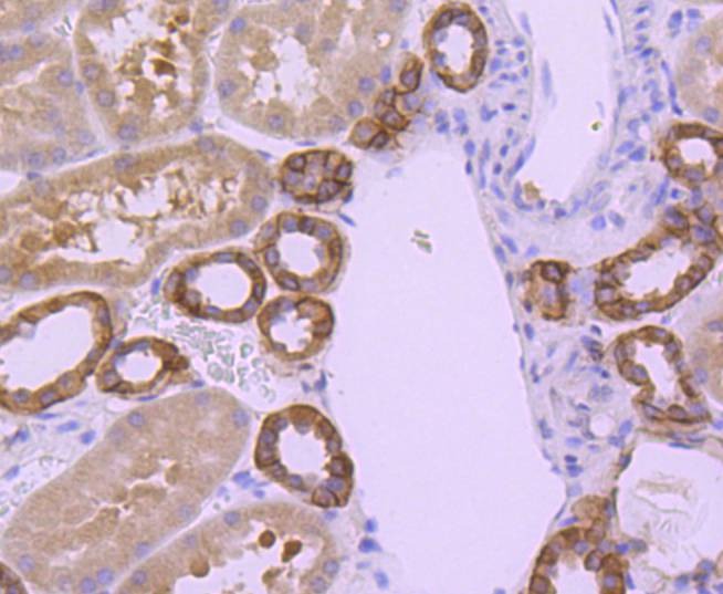 Anti-BCL-XL Antibody (3K493)