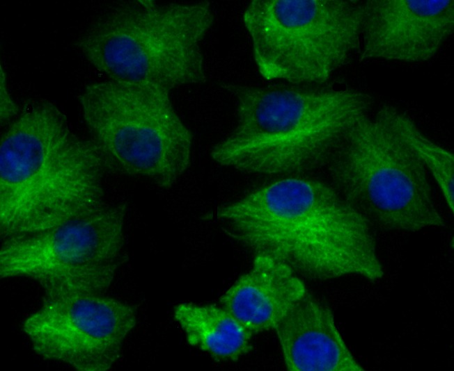 Anti-BCAP31 Antibody (4P206)