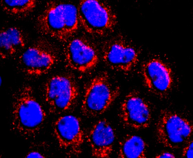 Anti-ATP5B Antibody (8V910)
